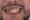 Sonrisa Antes